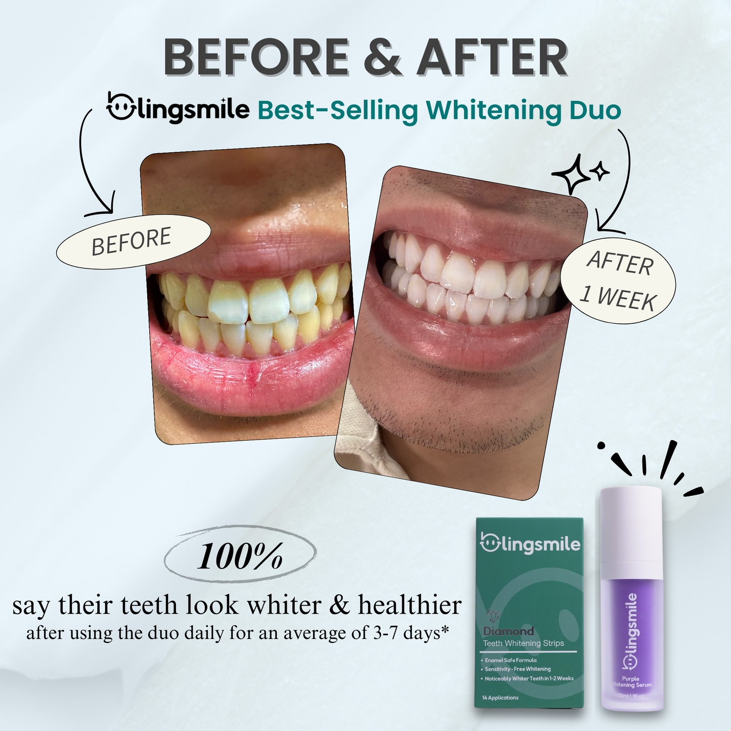 BlingSmile Whitening Duo