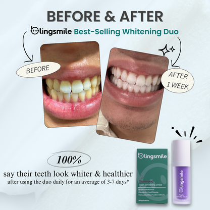 BlingSmile Whitening Duo